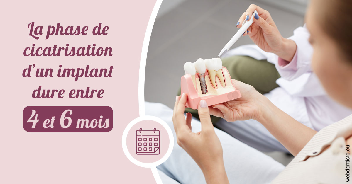https://selarl-etienne-et-associes.chirurgiens-dentistes.fr/Cicatrisation implant 2