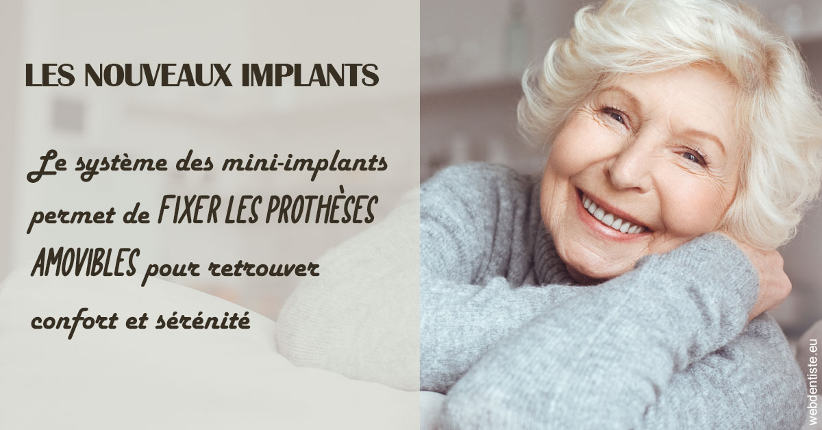 https://selarl-etienne-et-associes.chirurgiens-dentistes.fr/Les nouveaux implants 1