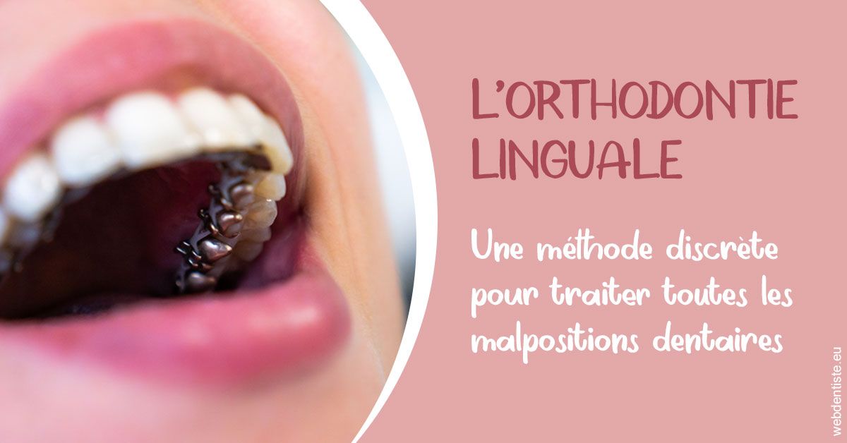 https://selarl-etienne-et-associes.chirurgiens-dentistes.fr/L'orthodontie linguale 2