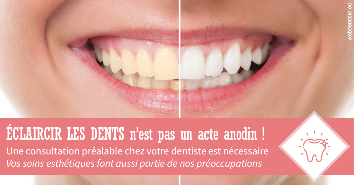 https://selarl-etienne-et-associes.chirurgiens-dentistes.fr/Eclaircir les dents 1