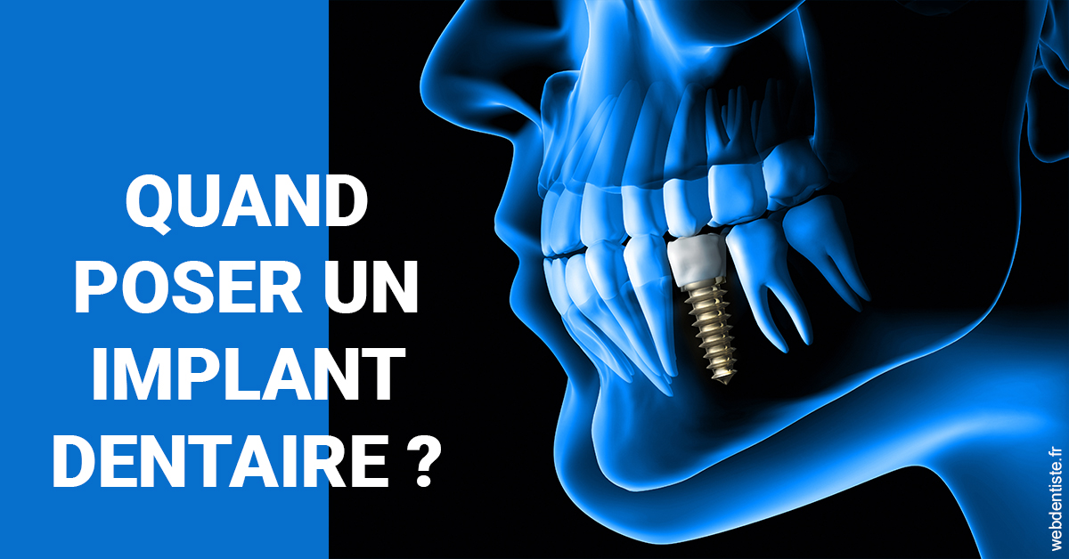 https://selarl-etienne-et-associes.chirurgiens-dentistes.fr/Les implants 1