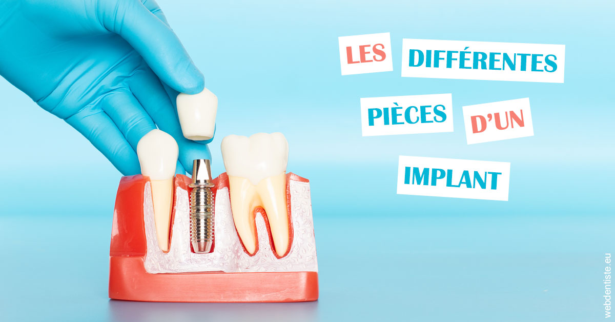 https://selarl-etienne-et-associes.chirurgiens-dentistes.fr/Les différentes pièces d’un implant 2