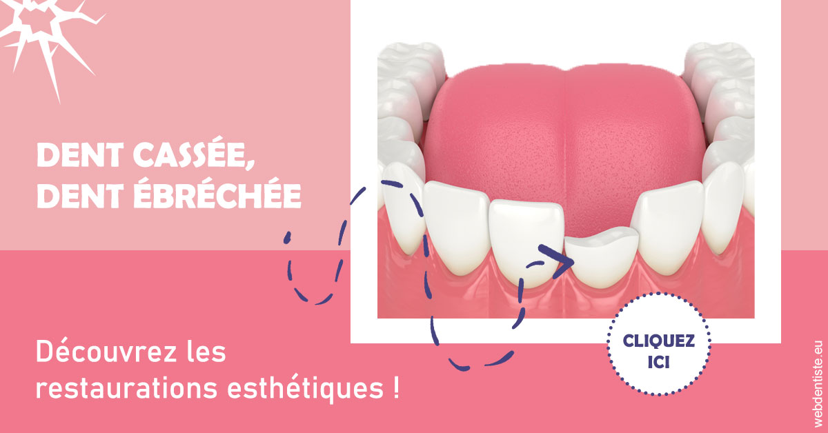 https://selarl-etienne-et-associes.chirurgiens-dentistes.fr/Dent cassée ébréchée 1