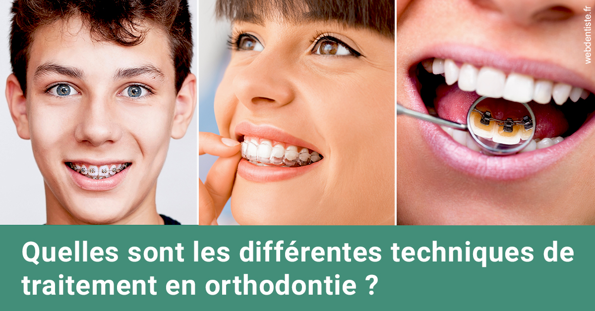 https://selarl-etienne-et-associes.chirurgiens-dentistes.fr/Les différentes techniques de traitement 2