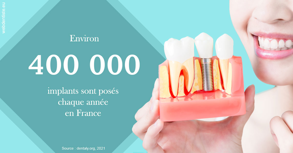 https://selarl-etienne-et-associes.chirurgiens-dentistes.fr/Pose d'implants en France 2
